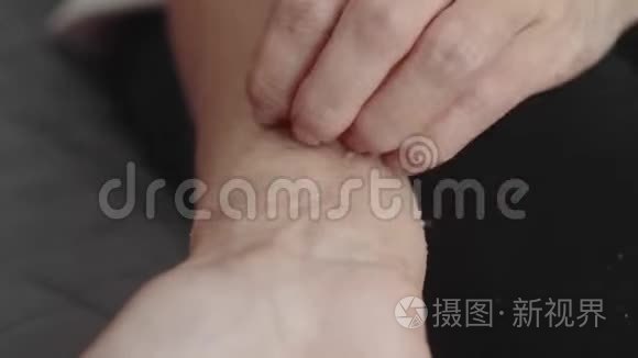 女人用皮炎抓她的手视频