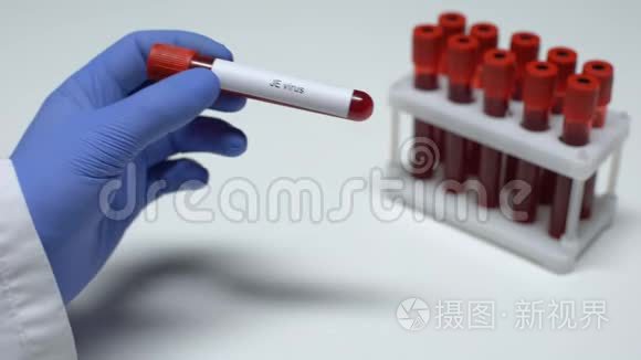 JE病毒，在试管中显示血样的医生，实验室研究，健康检查