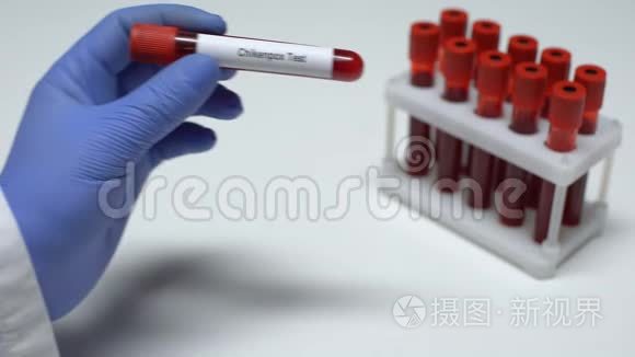 水痘，医生在试管中显示血样，实验室研究，健康检查