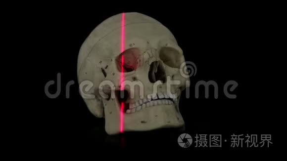 人颅骨模型激光线三维扫描视频