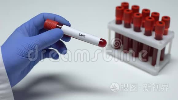 SARS检测，医生在试管中显示血样，实验室研究，健康检查