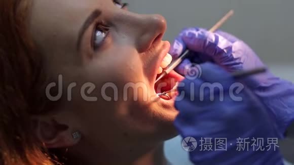 牙科医生给一个年轻女孩治牙视频