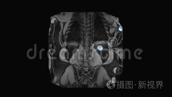 放射检查图像视频