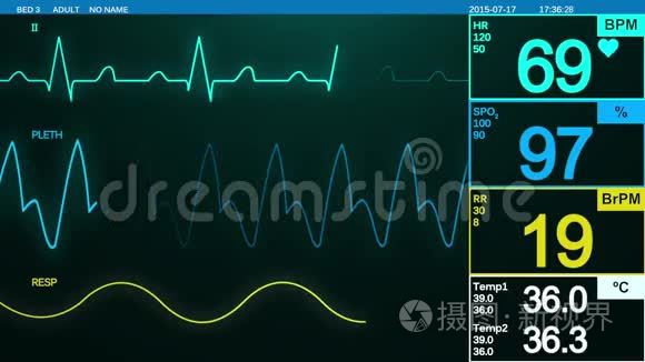 心跳监视器视频
