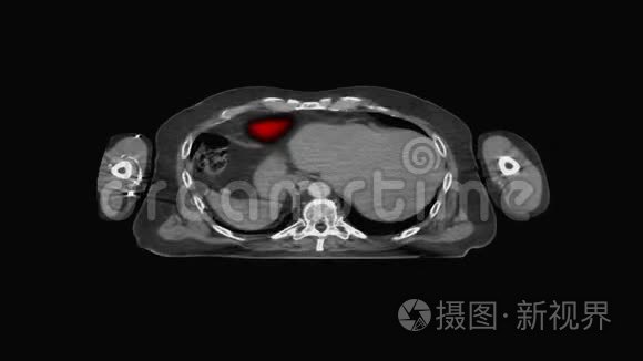 医学MRI扫描屏幕，CT或CAT扫描仪图像