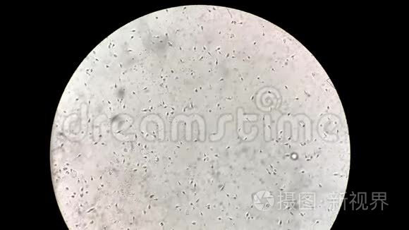 实验室显微镜下观察人类精子