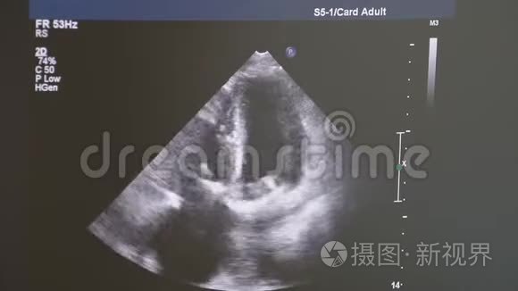 医生对病人进行超声波检查视频