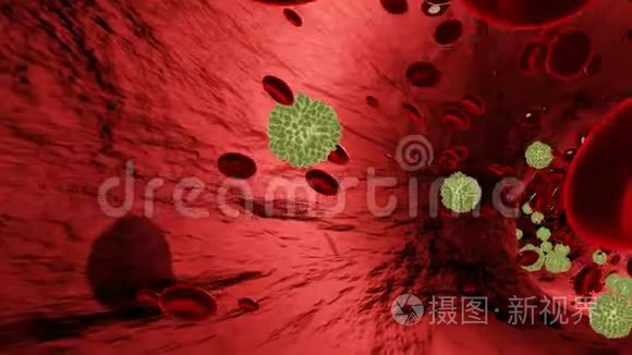 冠状病毒疾病COVID-19感染医学图解。 中国病原呼吸道流感covid病毒细胞.. 新官员