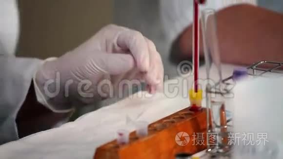 试管中血液的医学分析视频
