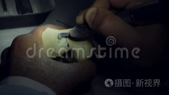 牙科医生拿着一个人的下巴模型视频