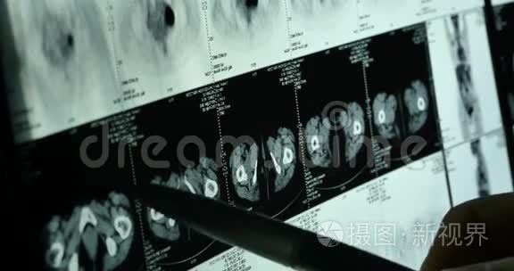 医生研究头骨脑X线片进行分析。健康医疗医院。