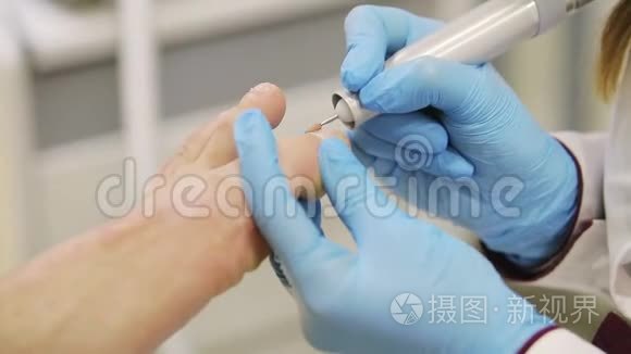 手术男性修脚用修脚器视频
