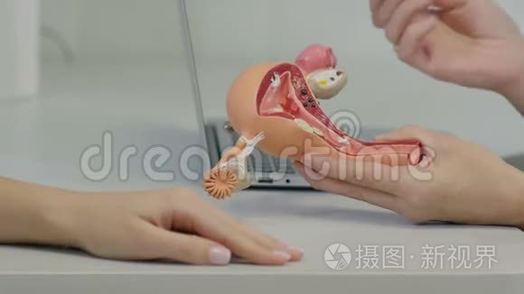 妇科医生会诊病人子宫解剖模型视频