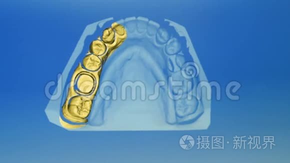 石膏义齿三维扫描视频