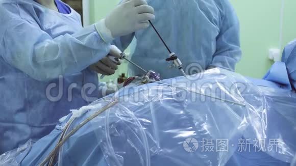 两名腹腔镜手术中的医生和护士视频