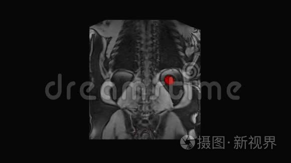 未来诊断放射学检查视频