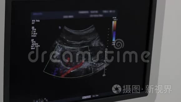 医生在肾动脉超声检查中显示颜色，特写