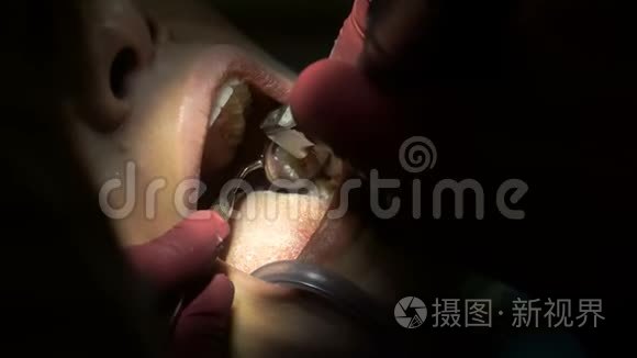 年轻女子从牙医那里治疗牙齿视频