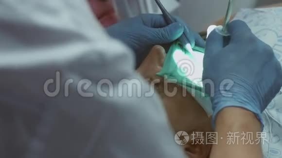 关闭女性患者面部牙齿治疗视频