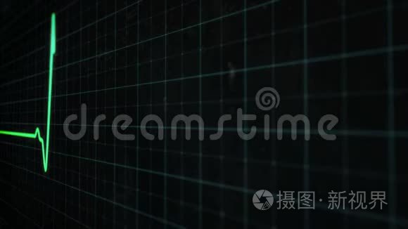 EK G心电图屏幕上的绿色心跳线