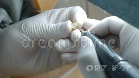 牙科技师在牙科实验室制作假牙视频
