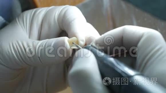 牙科技师在牙科实验室制作假牙