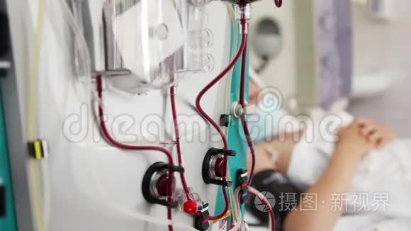 血液净化医疗程序的病人视频