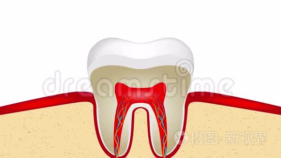 敏感牙釉质搏动视频动画视频