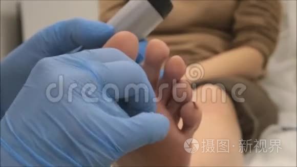 皮肤科医生用皮镜检查足底疣的病人mp4格式视频下载 正版视频编号04opl0 摄图新视界视频库