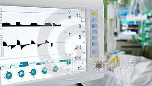 重症监护病房的肺部呼吸机视频